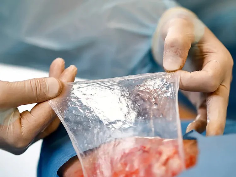 epiprotect sustituto piel epidérmica