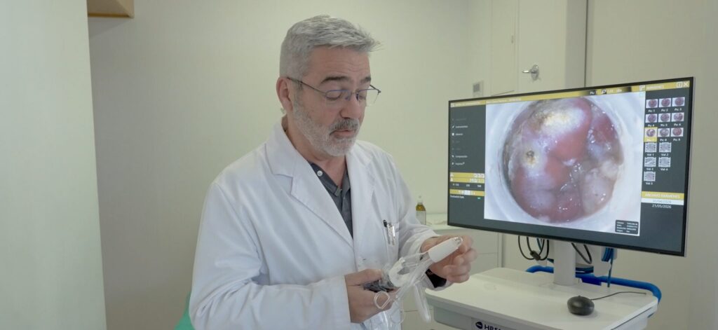 Anoscopio Biocablan